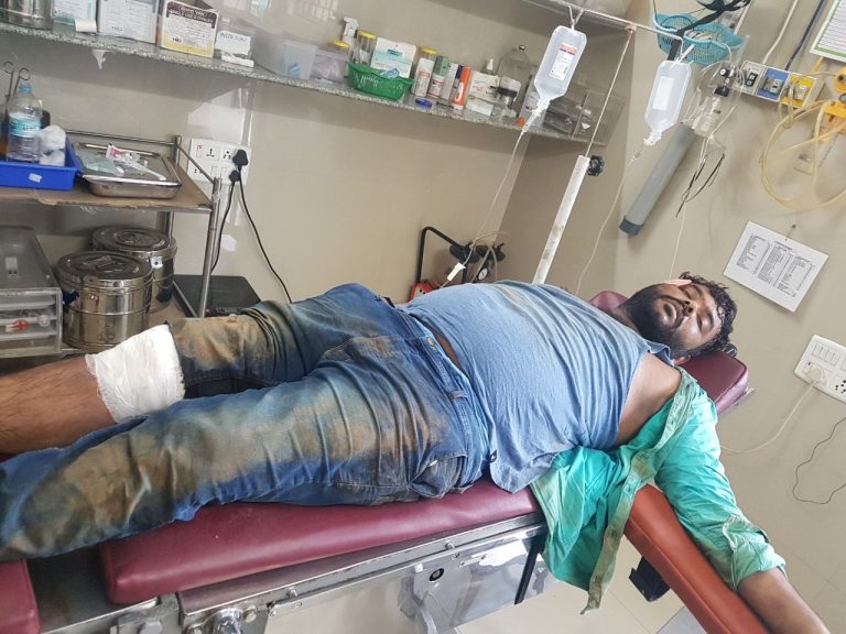 ಸರಗಳ್ಳನ ಮೇಲೆ ಪೊಲೀಸ್ ಫೈರಿಂಗ್