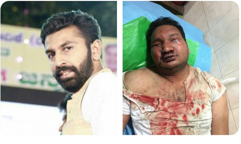 ವಿದ್ವತ್ ಮೇಲಿನ ಹಲ್ಲೆ ಪ್ರಕರಣ: ನಲಪಾಡ್‌ಗೆ ಜಾಮೀನು‌ ನೀಡಿದ ಹೈ!